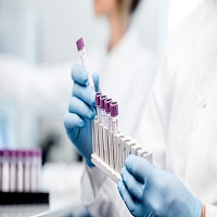 واردات واکسن کرونا تا دو ماه دیگر